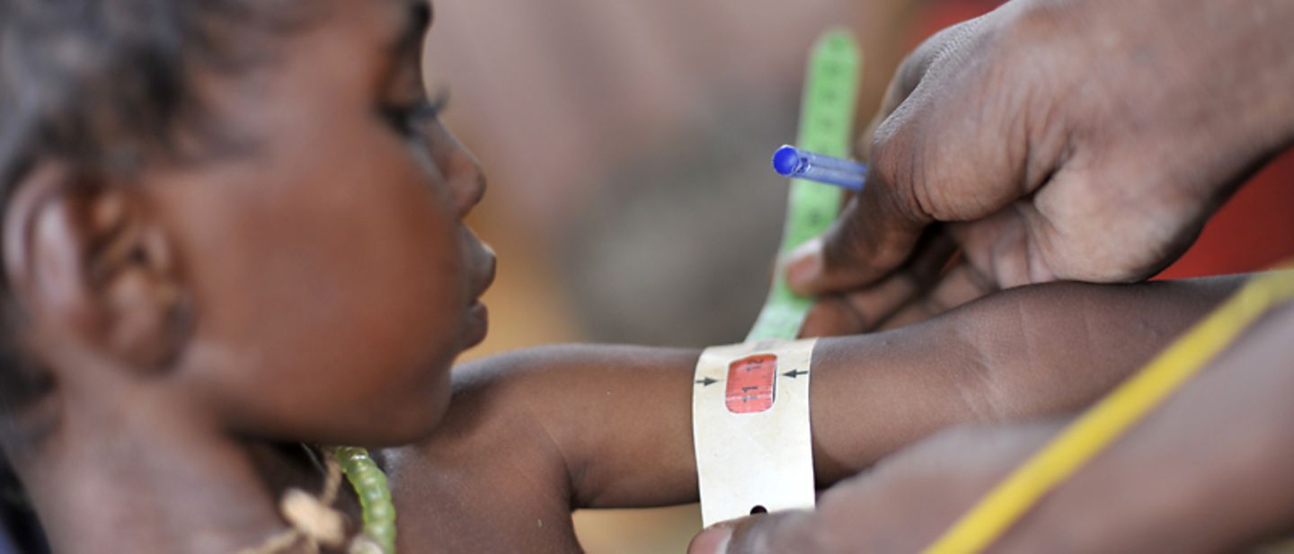 UNICEF in Kenia: Ein mangelernähertes Kind wird untersucht. 