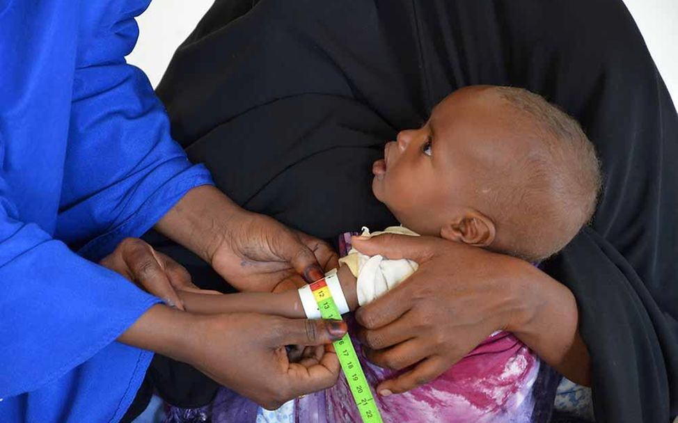 Drohende Hungersnot Somalia: Sorgfältige Kontrolle bei mangelernährten Kindern