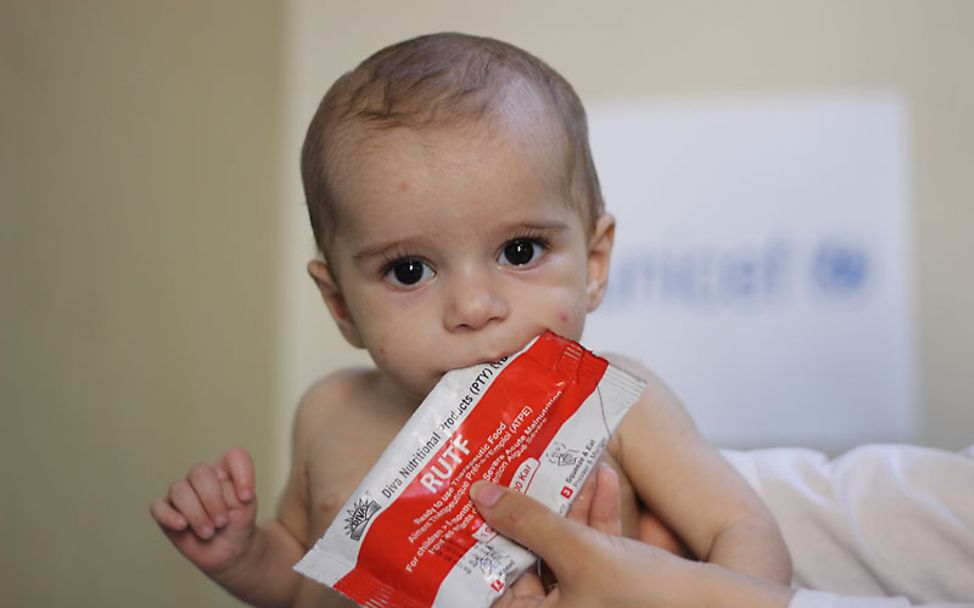 Aleppo: Ein mangelernährtes Kind erhält therapeutische Nahrung.