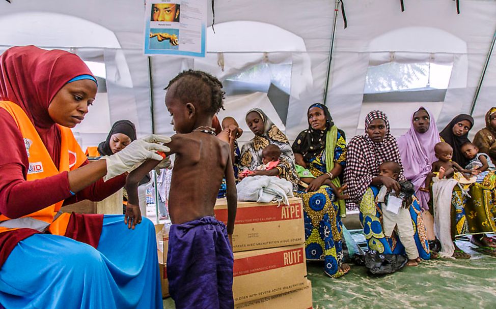 Hungersnot: Eine UNICEF-Helferin untersucht ein Kleinkind auf Mangelernährung