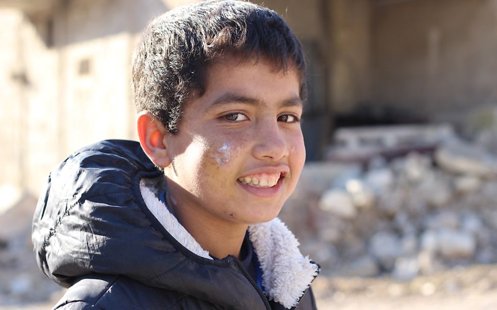 Syrien: Der 13-jährige Majed wurde Opfer eines Blindgängers in Aleppo