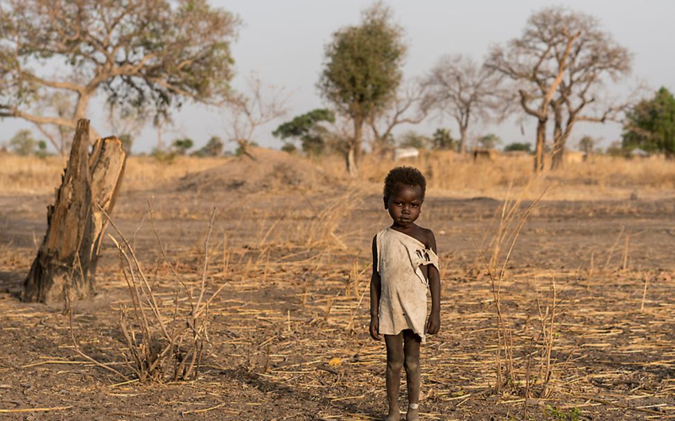 Südsudan: Ein mangelernährtes Kind steht in der Steppe