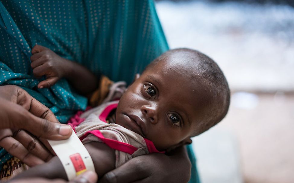 Somalia: Weil das Maßband Rot anzeigt ist klar, dass das Mädchen schwer unterernährt ist