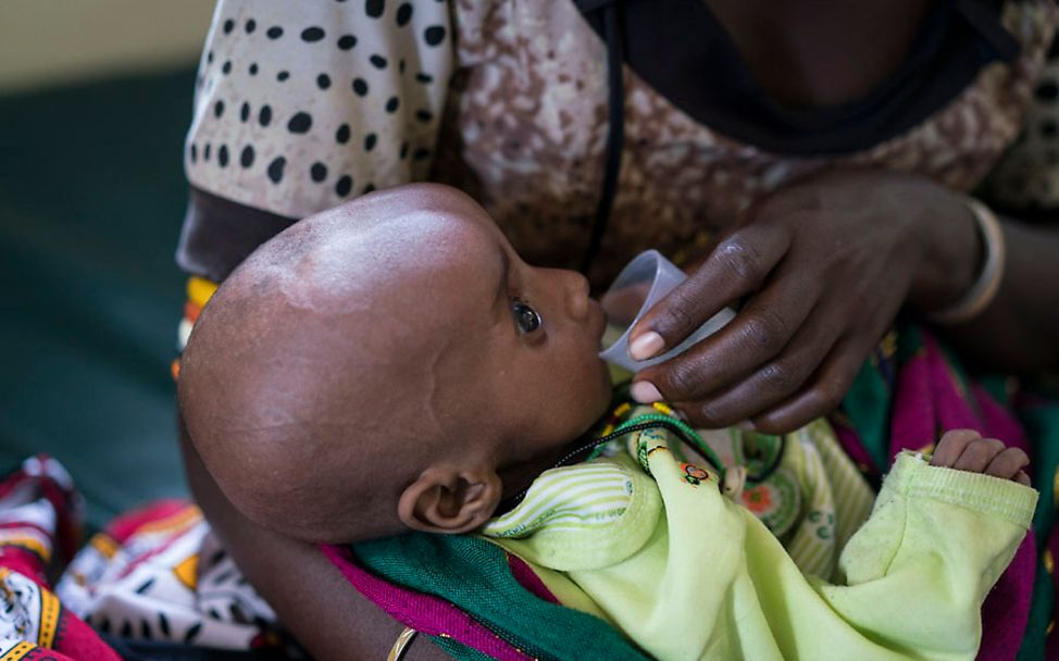 Dürre in Kenia: Der schwer akut mangelernährte Esekon wird versorgt