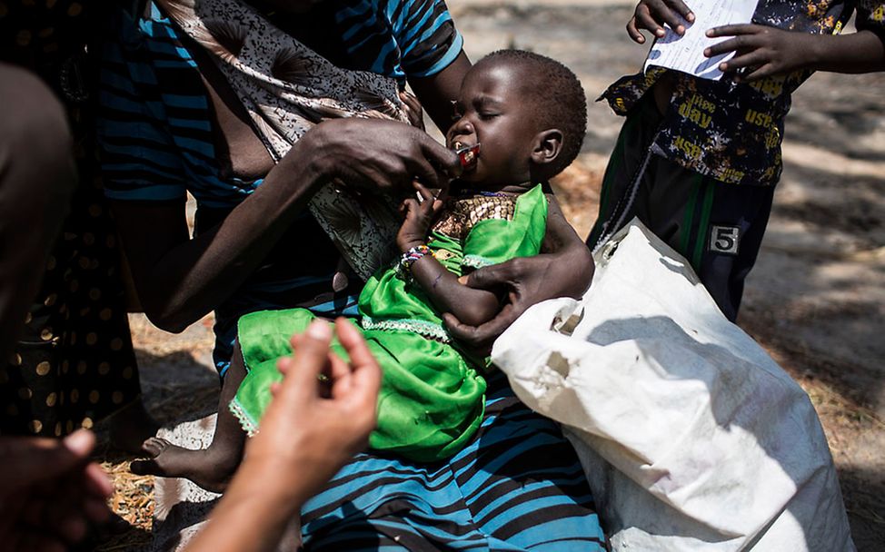 Südsudan: Ein mangelernährtes Kind wird gefüttert