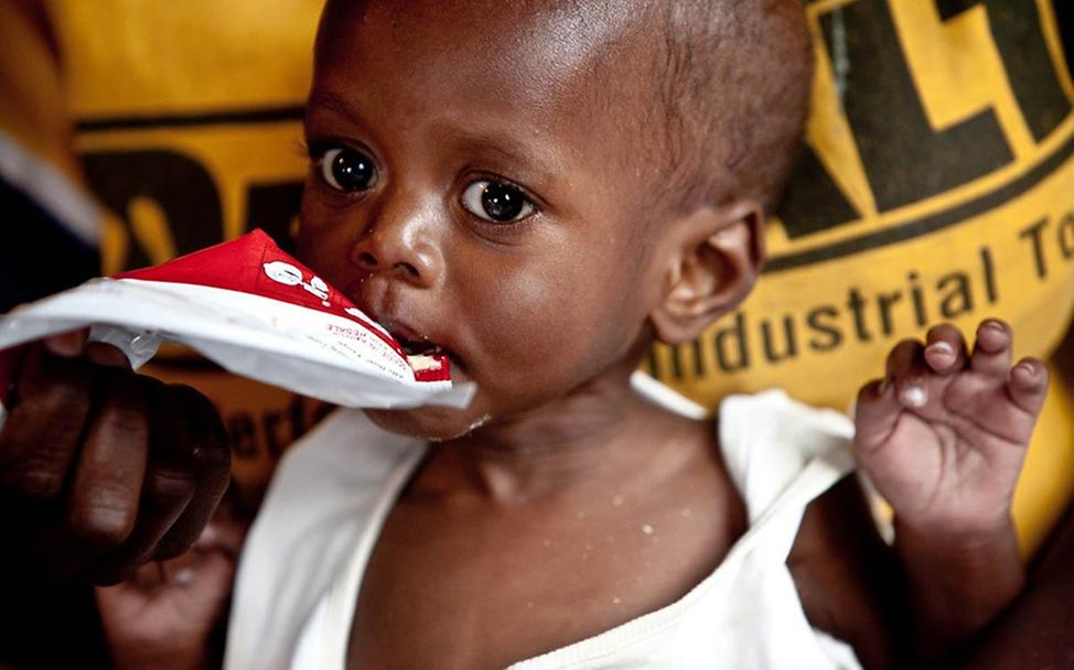 Hungerkrise in Afrika: Der elf Monate alte Johannes in Ostafrika erhält stärkende Erdnusspaste. 