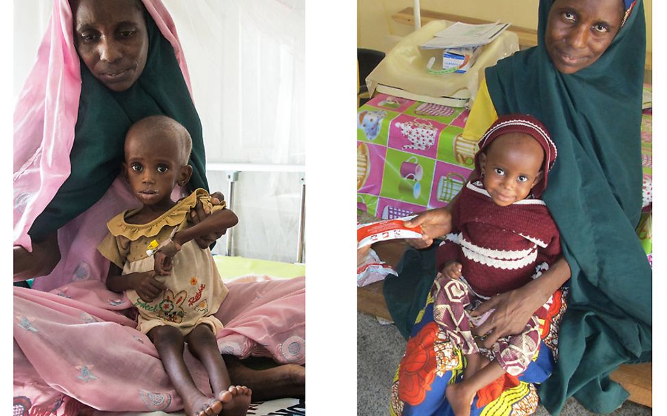 Nigeria: Khadija wurde mit therapeutischer Nahrung versorgt