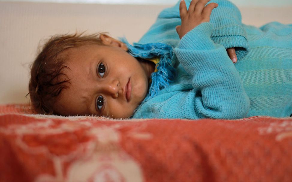 Krieg im Jemen: Kinder wie Ruba leiden unter der anhaltenden Gewalt
