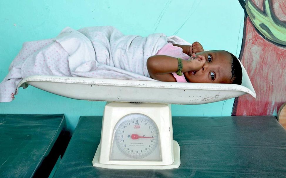 Drohende Hungersnot Somalia: Ein Baby wird gewogen