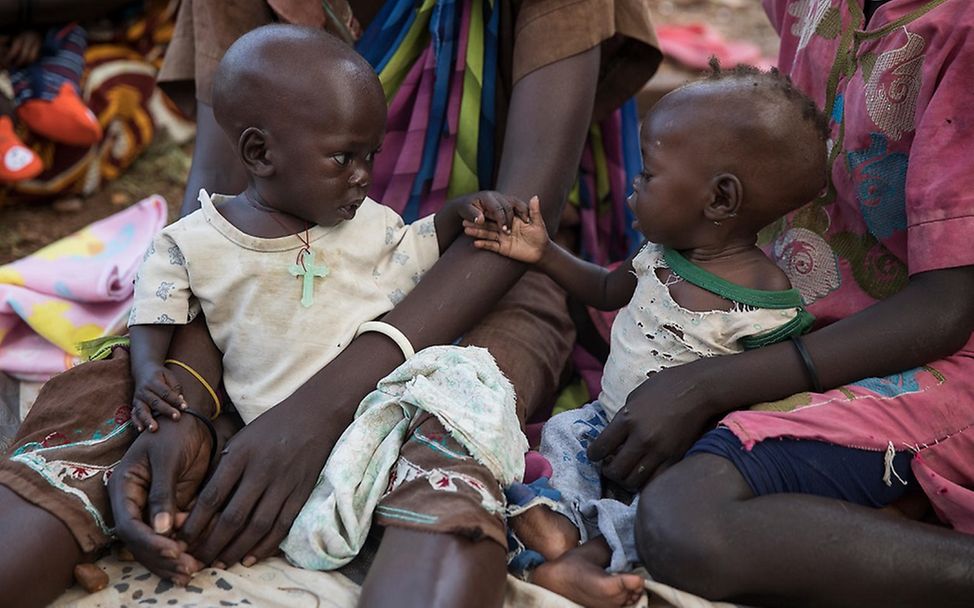 UN-Bericht weltweiter Hunger: Mangelernährte Kinder in einem Krankenhaus in Juba, Südsudan