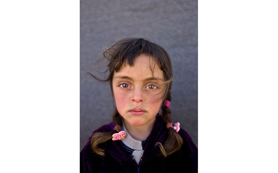 Syrien: Das Gesicht einer geschundenen Kindheit. © Muhammed Muheisen/AP/dpa