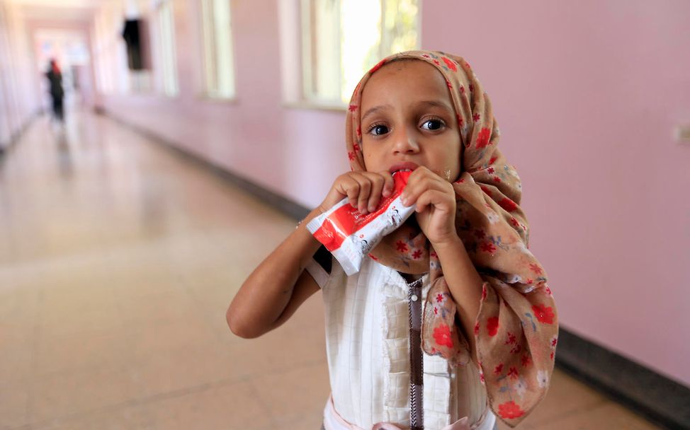 Drohende Hungersnot im Jemen: Ein mangelernährtes Mädchen isst im Krankenhaus angereicherte Erdnusspaste.