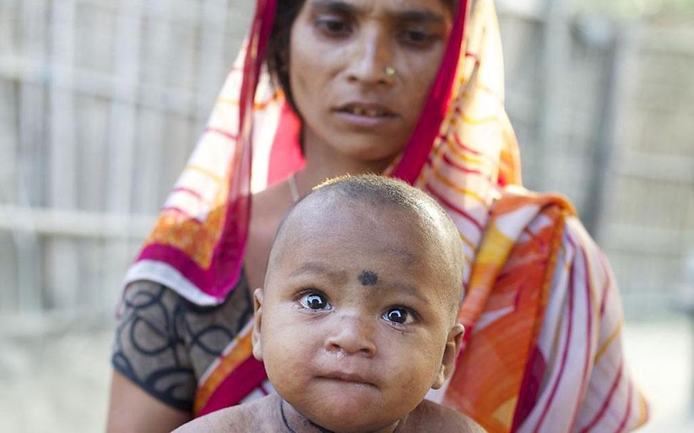 Mutter mit ihrem an Masern erkranktem Sohn (© UNICEF/NYHQ2012-1656/Pietrasik)