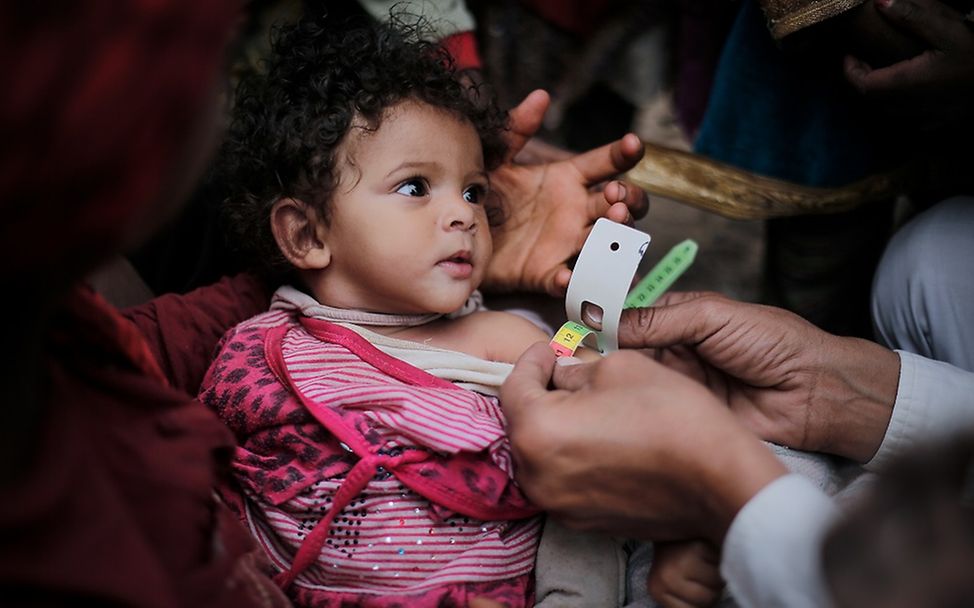 Ein Arzt misst den Umfang des Oberarms eines mangelernährten Mädchen im Jemen.