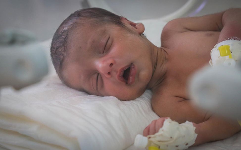 Jemen: Die neugeborene Sohaya auf der Babystation im Krankenhaus in Dolaa Hamdan.