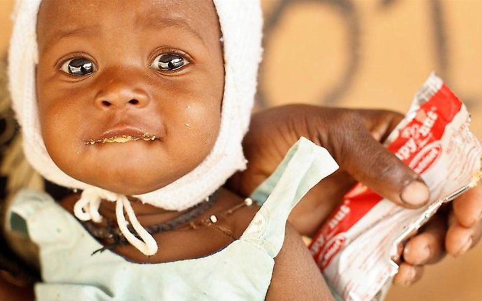 Erdnusspaste rettet Leben | © UNICEF/Olivier Asselin