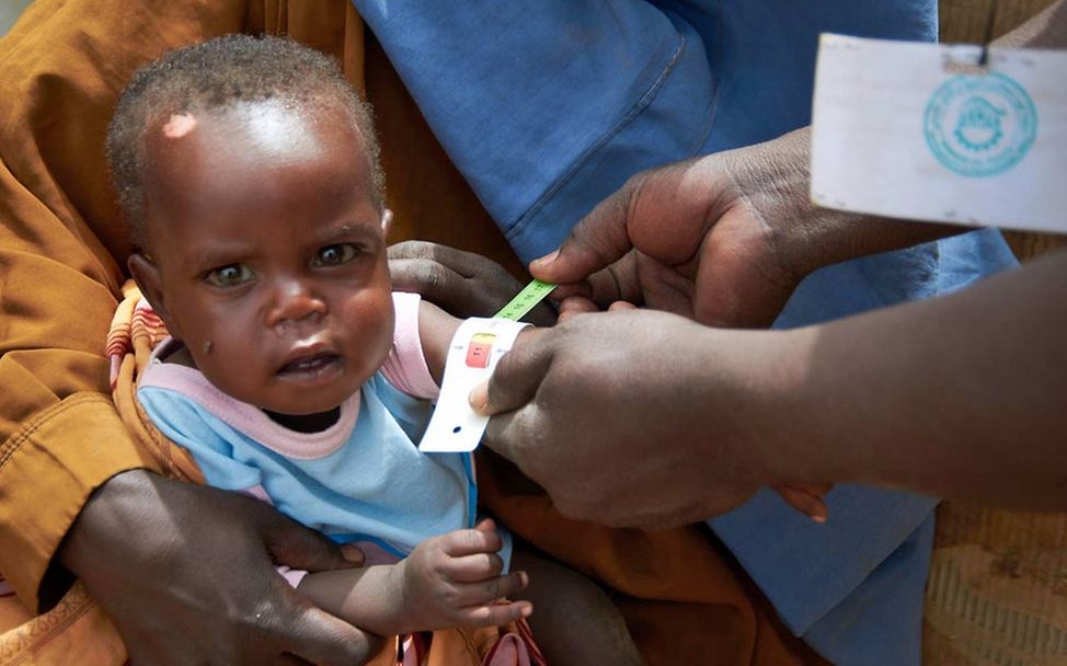 Sudan Konflikt: Ein Kleinkind gilt als unterernährt, wenn das Maßband im roten Bereich ist. 