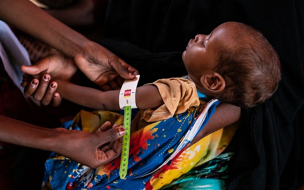 Um eine Mangelernährung feststellen zu können, wird von einem Kind in Somalia der Oberarmumfang gemessen.
