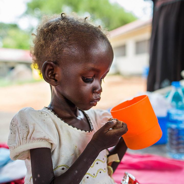 Südsudan: Die mangelernährte Maria mit einem Becher Spezialmilch