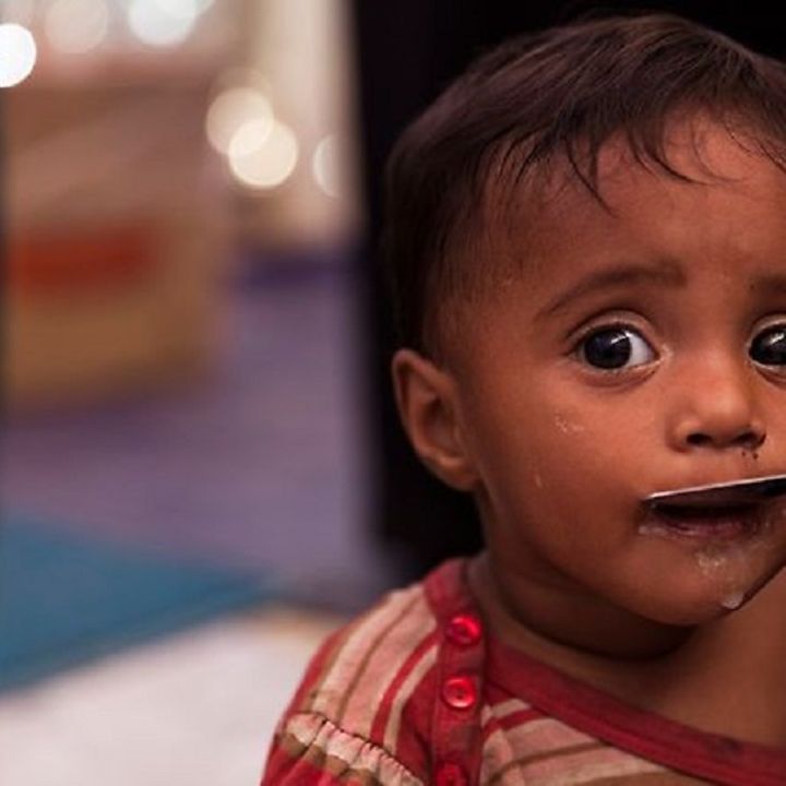 There are still many children suffering from malnutrition worldwide © UNICEF/UN0151415/Brown