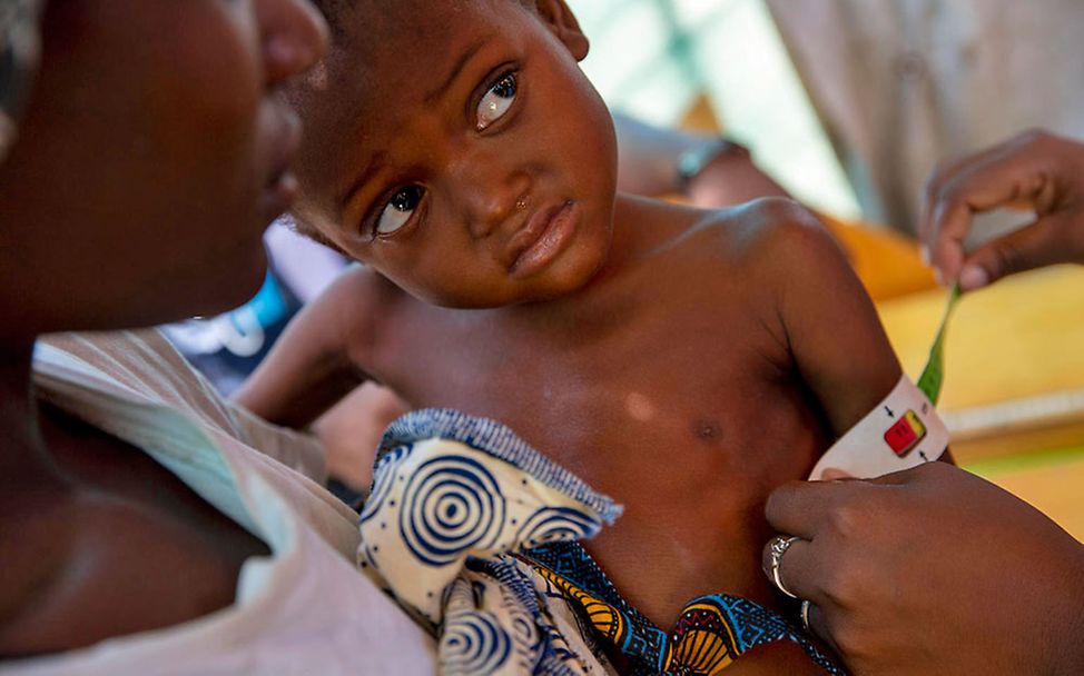 Mangelernährung in Mosambik: Die Kinder brauchen Lebensmittel, um zu überleben.