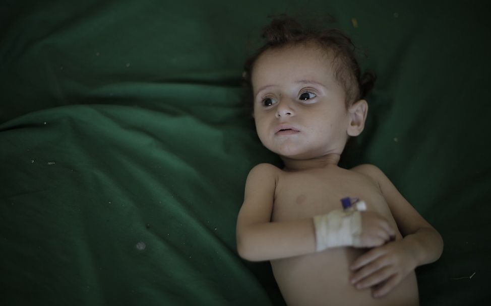 Ein unterernährtes jemenitisches Baby © UNICEF Yemen/2018/Ahmed 