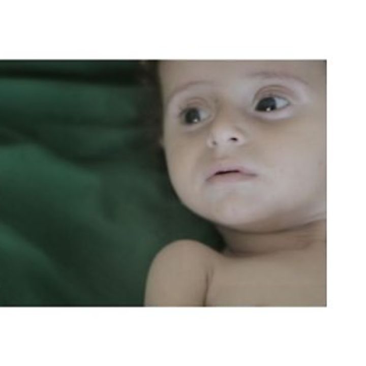 Hilfe für Kinder im Jemen