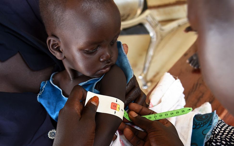 Hunger in Afrika: Ein Kind im Südsudan wird auf Mangelernährung untersucht. 