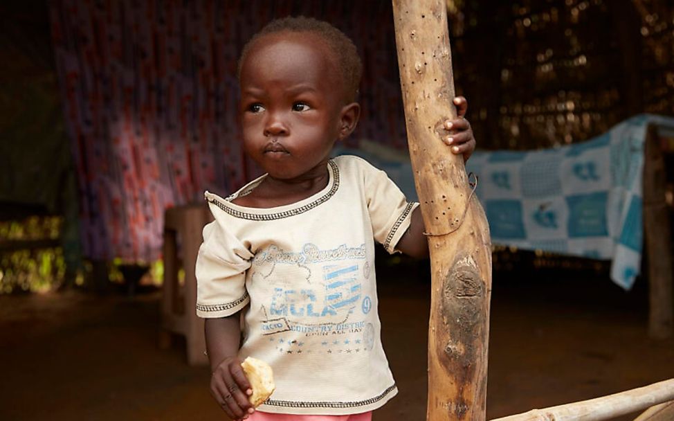 Mangelernährung im Südsudan: Adut ist zu klein und zu leicht für ihr Alter