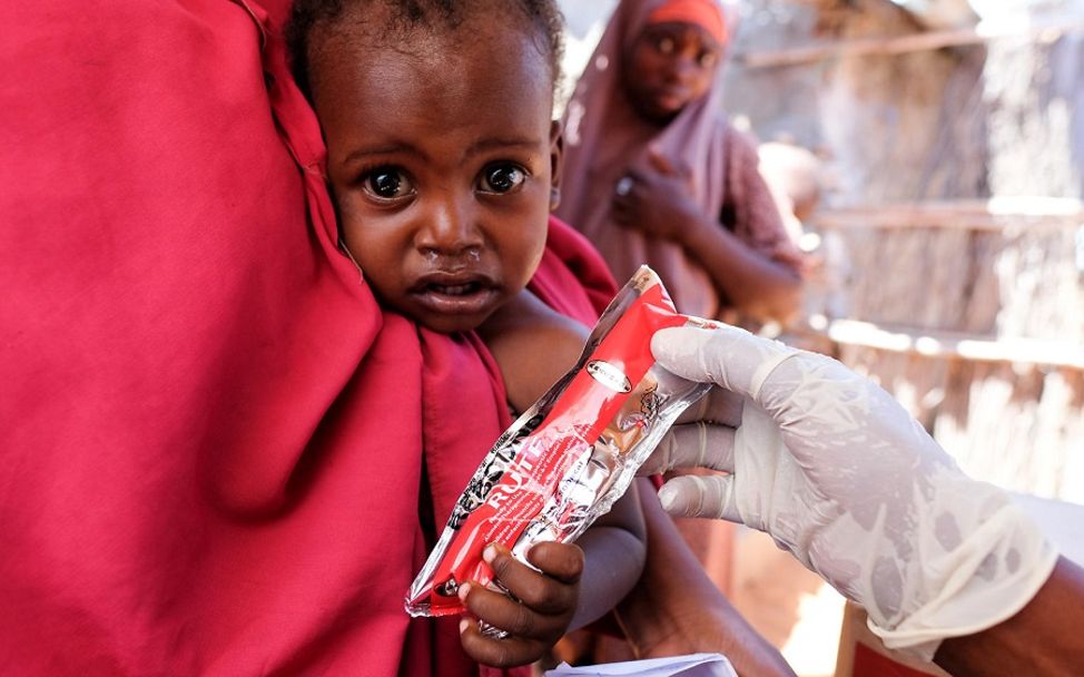 Somalia spenden gegen drohende Hungersnot: Ein Baby bekommt Erdnusspaste.
