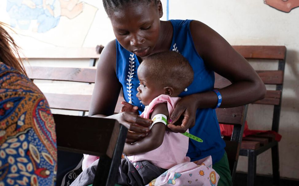 Mangelernährung im Südsudan: Eine Mutter misst den Armumfang ihres Kindes