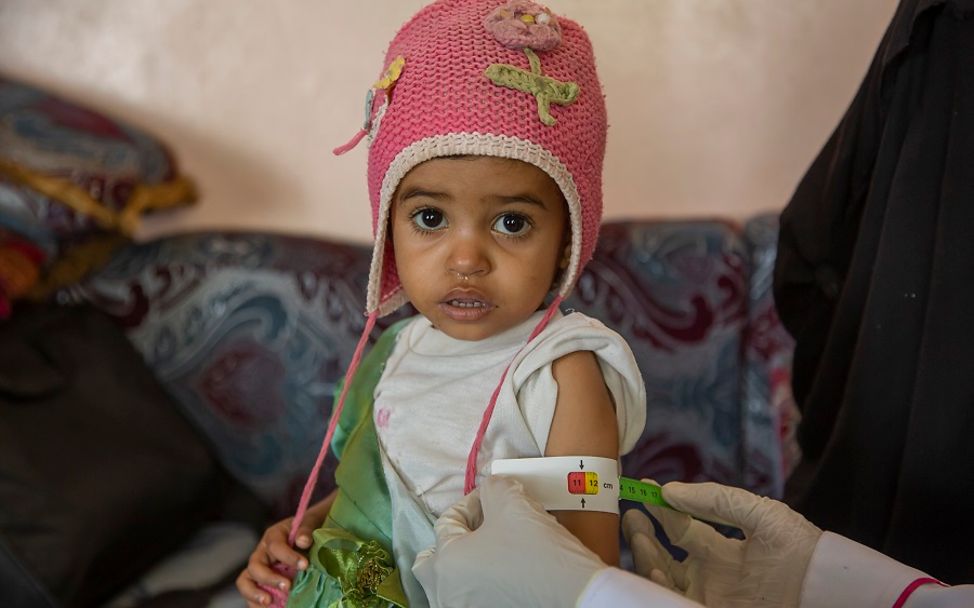 Jemen: Mit einem Maßband wird untersucht, wie stark das Mädchen mangelernährt ist.
