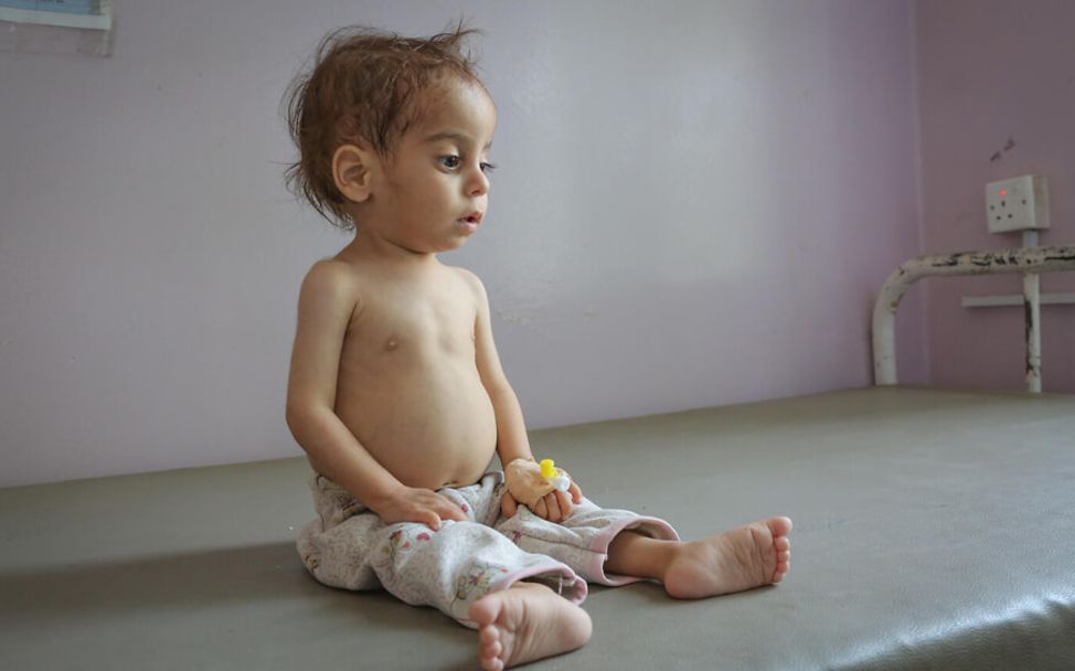 Jemen: Ein mangelernährtes Kind sitzt auf einem Krankenbett