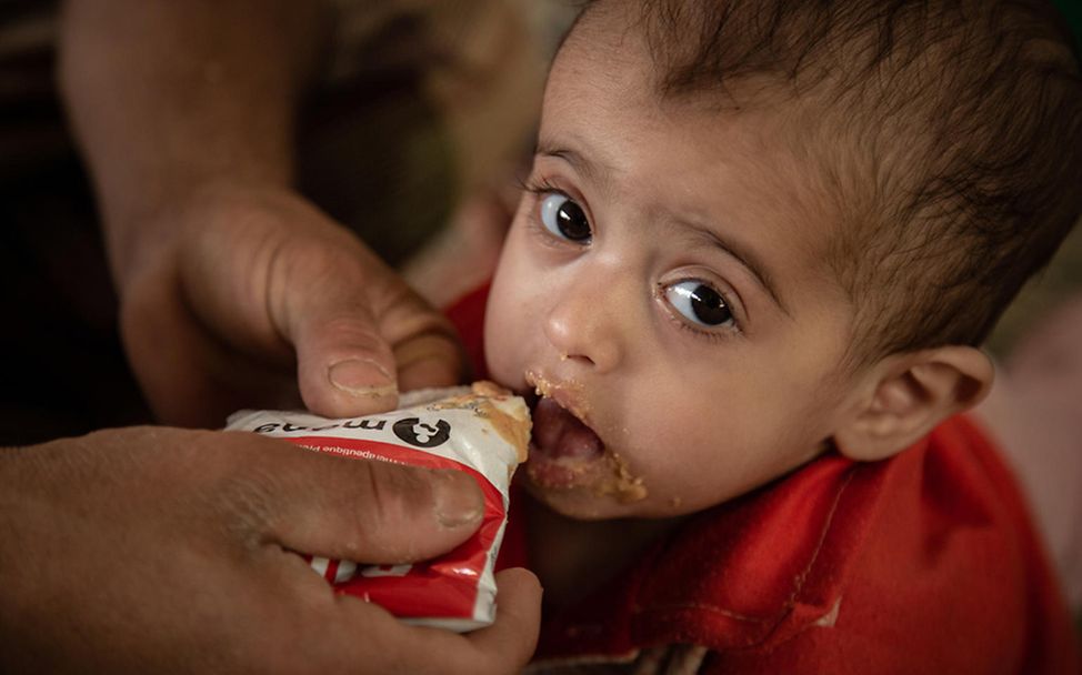 Jemen: Arwa nimmt Erdnusspaste zu sich.
