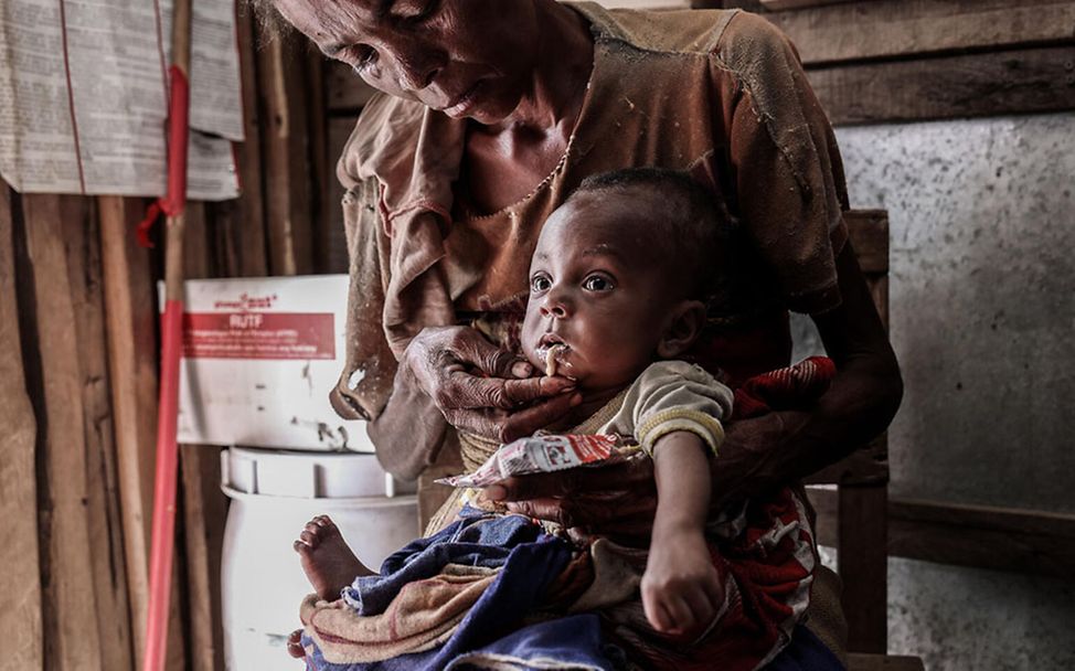 Hunger in Madagaskar: Ein Baby bekommt Erdnusspaste