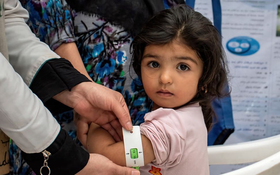 Afghanistan-Krise: Ein Mädchen wird auf Mangelernährung hin untersucht. 