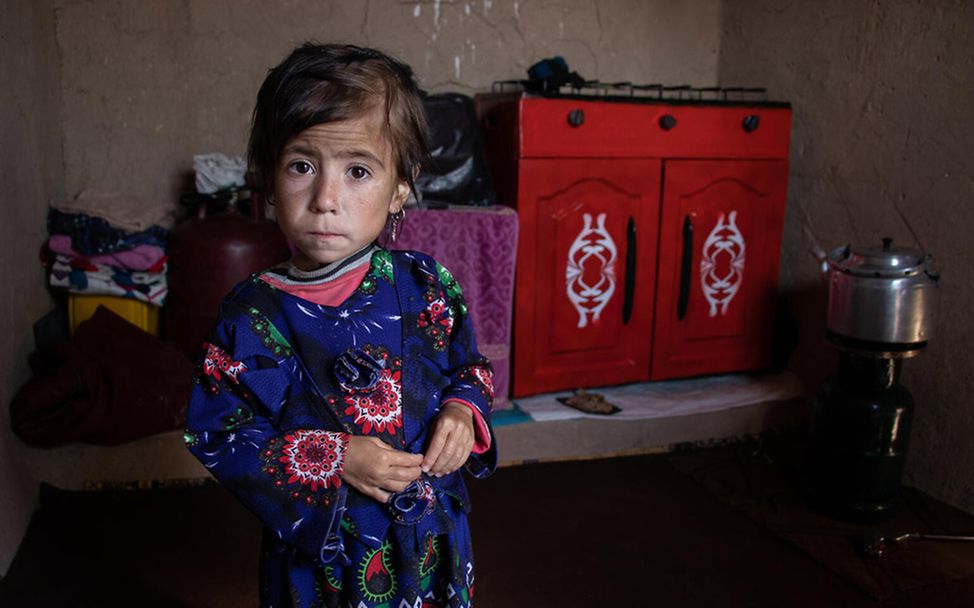 Mangelernährung in Afghanistan: Parwana (4) ist schwer akut mangelernährt