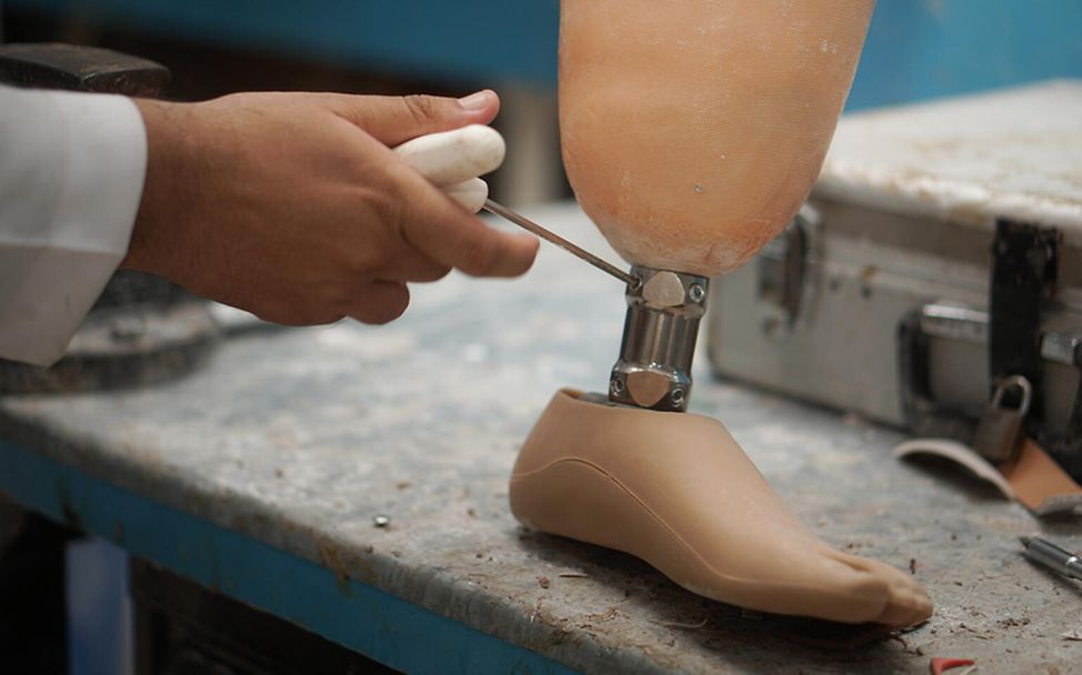 Jemen: Eine Prothese wird hergestellt