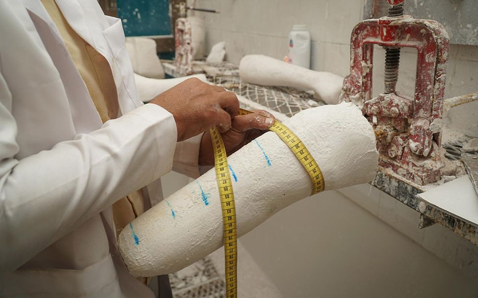 Jemen: Eine Beinprothese wird gefertigt