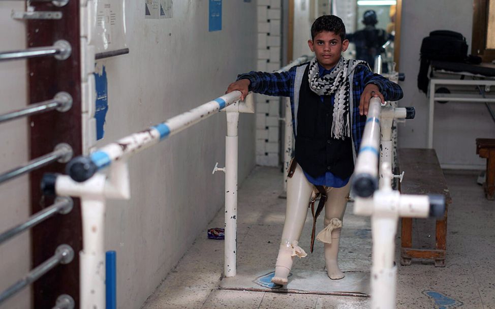 Minen im Jemen: Ibrahim hat Prothesen bekommen und übt, damit zu laufen