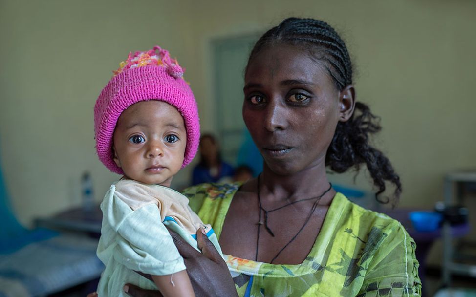Äthiopien Hungerkrise: Ein unterernährtes Baby bekommt Spezialnahrung gegen den Hunger.