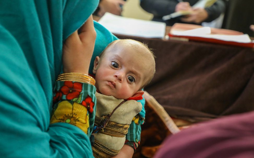 Afghanistan: Ein Baby ist mangelernährt