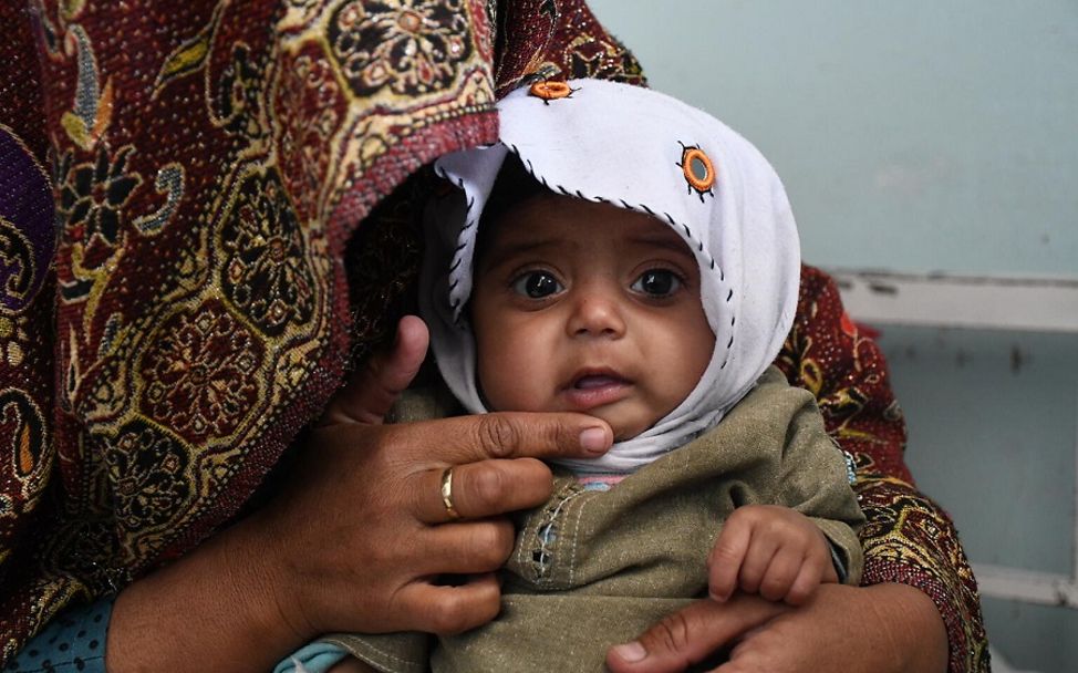 Afghanistan: Ein 8-Monate alter Junge wird auf Mangelernährung untersucht.
