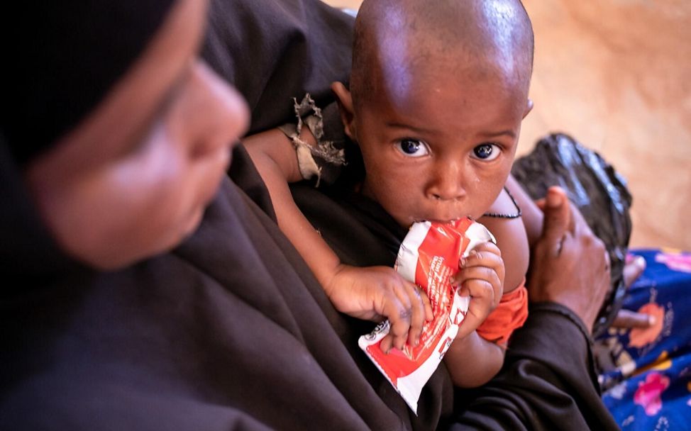 Somalia: Ein Kinder erhält auf dem Schoß seiner Mutter therapeutische Erdnusspaste.