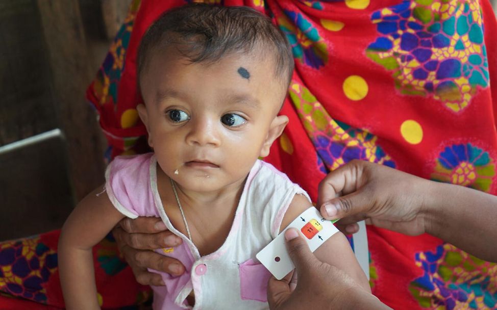 Mangelernährung in Bangladesch: Mithilfe eines Maßbands wird bei einem Kind der Armumfang gemessen.