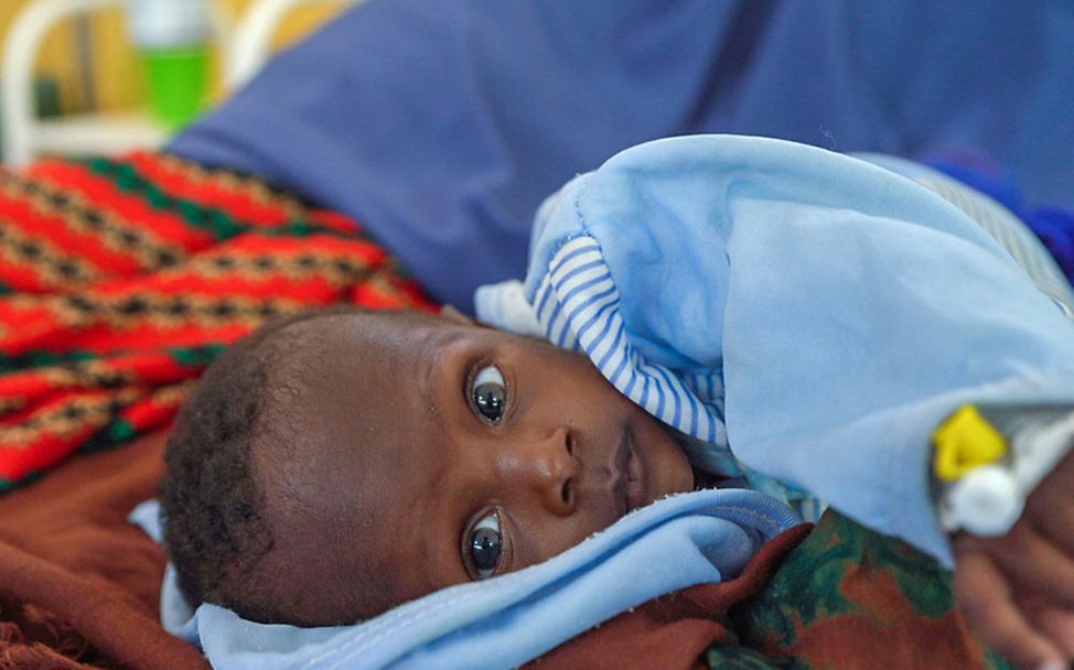 Hungersnot Afrika verhindern: Dieses Kleinkind in Somalia konnte mit Spezialnahrung gerettet werden.