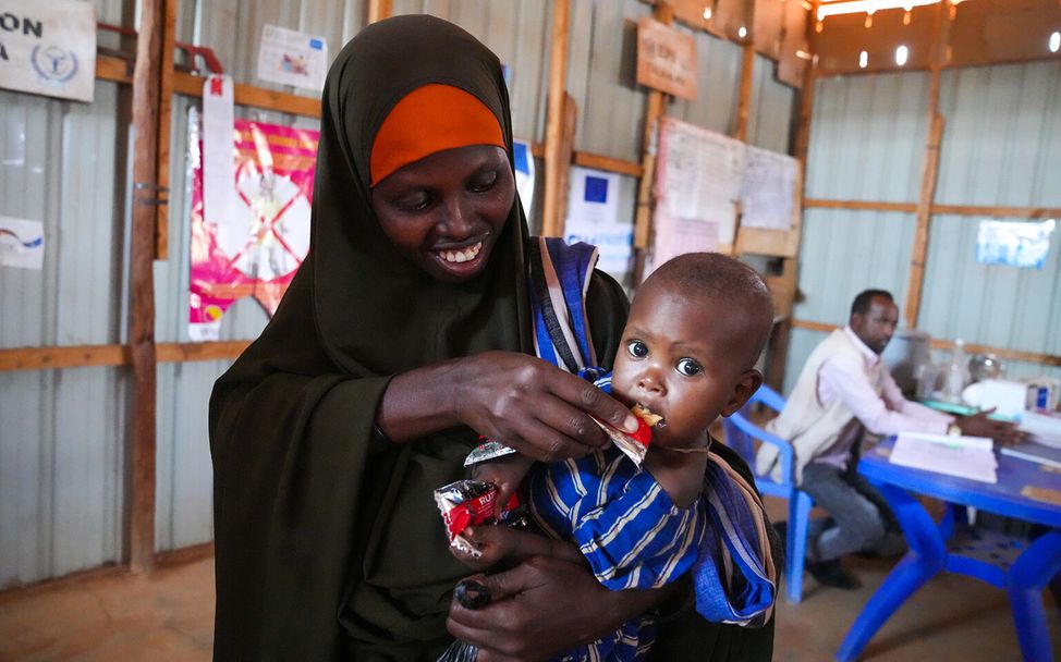 UNICEF in Somalia: Ein mangelernährtes Mädchen wird mit Erdnusspaste behandelt. 