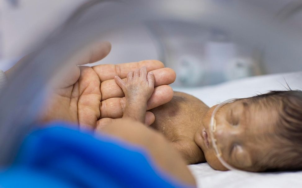 Kindersterblichkeit: Viele Babys sterben bei Geburt