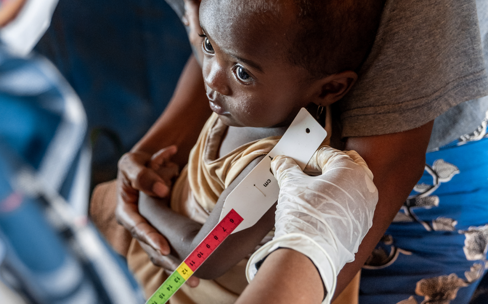 Madagaskar: Ein Kind wird auf Mangelernährung hin untersucht.