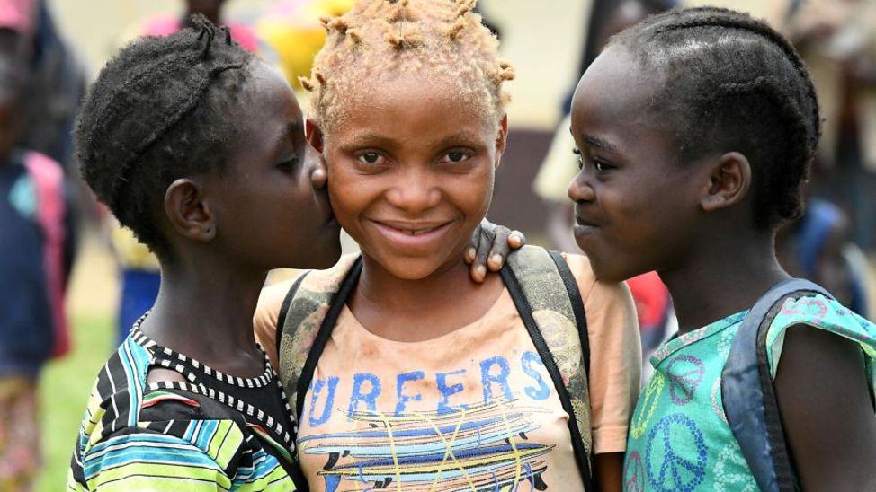 Kongo: Ein Mädchen mit Albinismus steht mit zwei weiteren Mädchen zusammen.